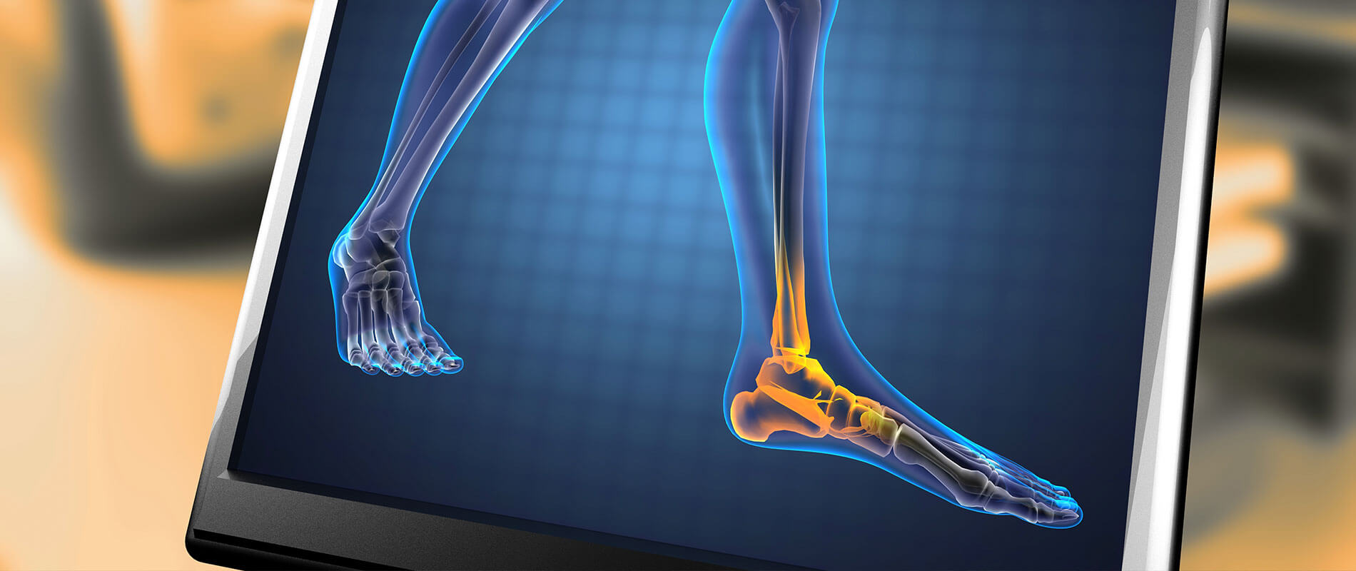 Ascend Foot & Ankle Center Podiatrist, Foot Doctor Lafayette, CO 80026