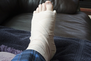 Foot Fractures in Pickleball Play